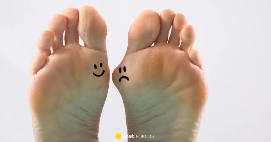 Jodyna na haluksy: czy to działa? Skutki uboczne i alternatywy